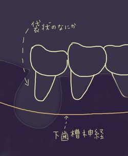 レントゲン レントゲン