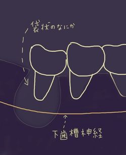 レントゲン